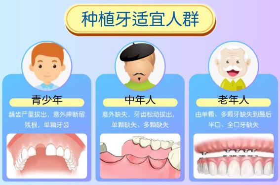 种植牙手术科普