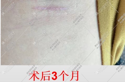 郭树忠再造耳成效图展示