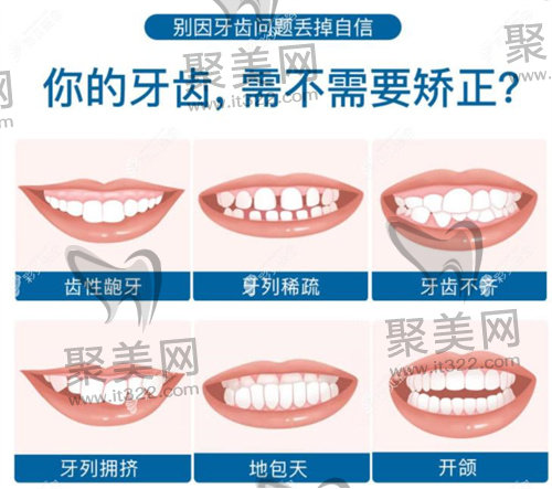 金属托槽矫正