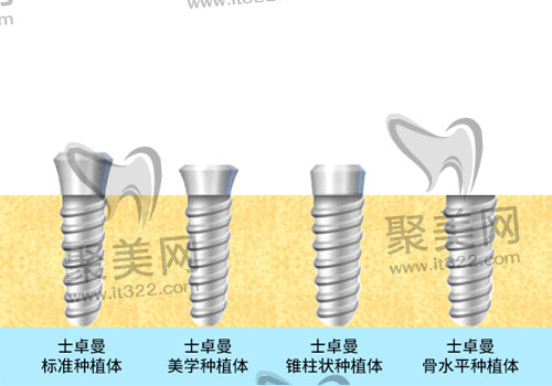 瑞士ITI士卓曼种植体