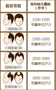 南宁贞韩微创无痕植发技术 防脱、固发、生发、植发均可见效果