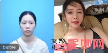 北京东方和谐点评好是广告推出来的吗?东方和谐真人案例效果_价格表